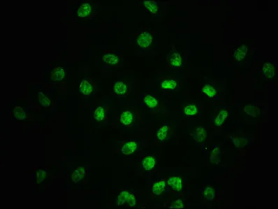 Phospho-SMAD2 (S255) Recombinant Monoclonal Antibody - image 1