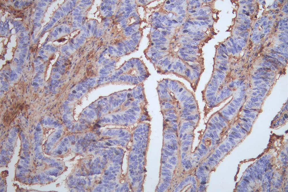 OCLN Recombinant Monoclonal Antibody - image 1