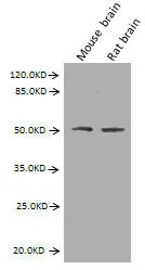 GFAP Monoclonal Antibody - image 1