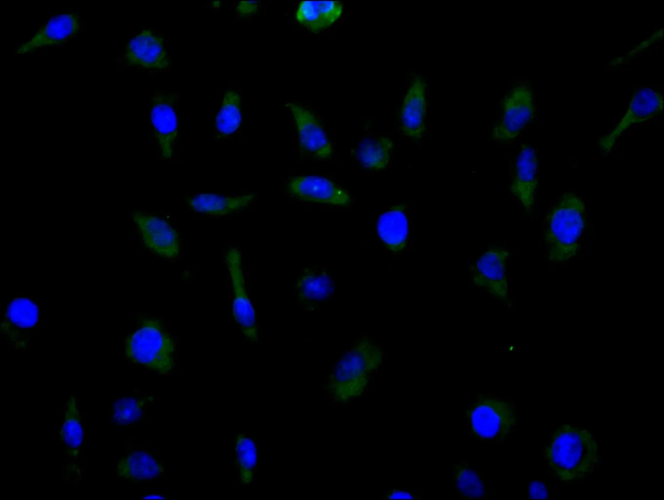 SLC1A5 Recombinant Monoclonal Antibody - image 1