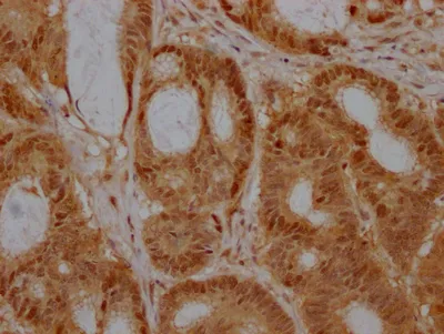 EZH2 Recombinant Monoclonal Antibody - image 1