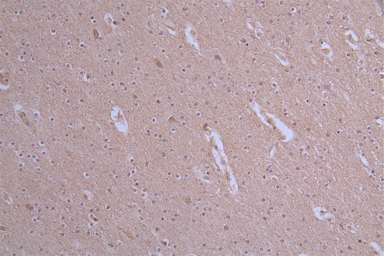 ATP7B Recombinant Monoclonal Antibody - image 1