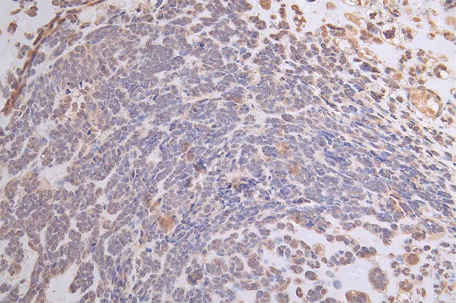 ATP7B Recombinant Monoclonal Antibody - image 2