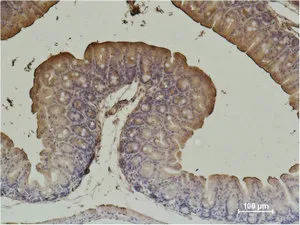 ACTA2 Monoclonal Antibody - image 1