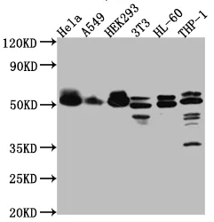 MAPKAPK2 Recombinant Monoclonal Antibody - image 1