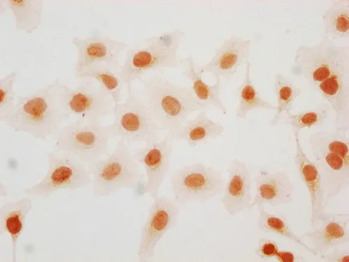 2-hydroxyisobutyryl-HIST1H2BC (K57) Antibody - image 1