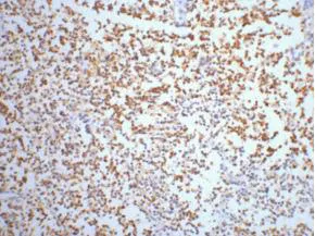 ENO2 Monoclonal Antibody - image 1
