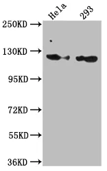 RNF20 Recombinant Monoclonal Antibody - image 1