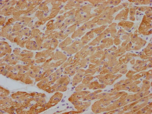 ACTB/POTEKP/ACTG1 Monoclonal Antibody - image 1