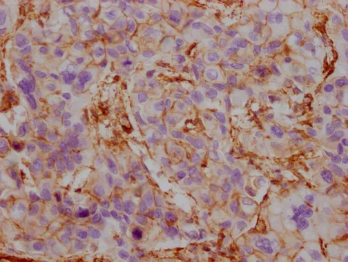 ACTB/POTEKP/ACTG1 Monoclonal Antibody - image 2