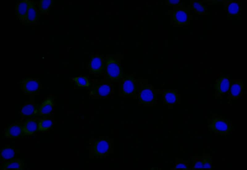 LYVE1 Recombinant Monoclonal Antibody - image 1