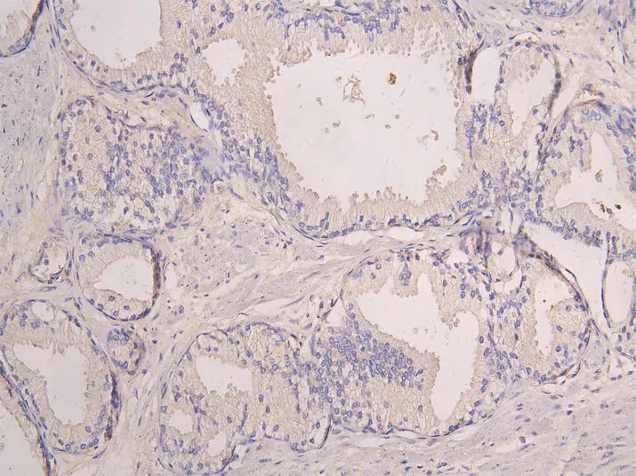 SIGLEC8 Recombinant Monoclonal Antibody - image 1