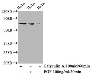 Phospho-RAF1 (S259) Recombinant Monoclonal Antibody - image 1