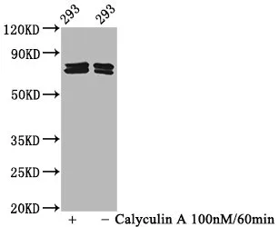 Phospho-PAK4/PAK5/PAK6 (S474/S560/S602) Recombinant Monoclonal Antibody - image 1