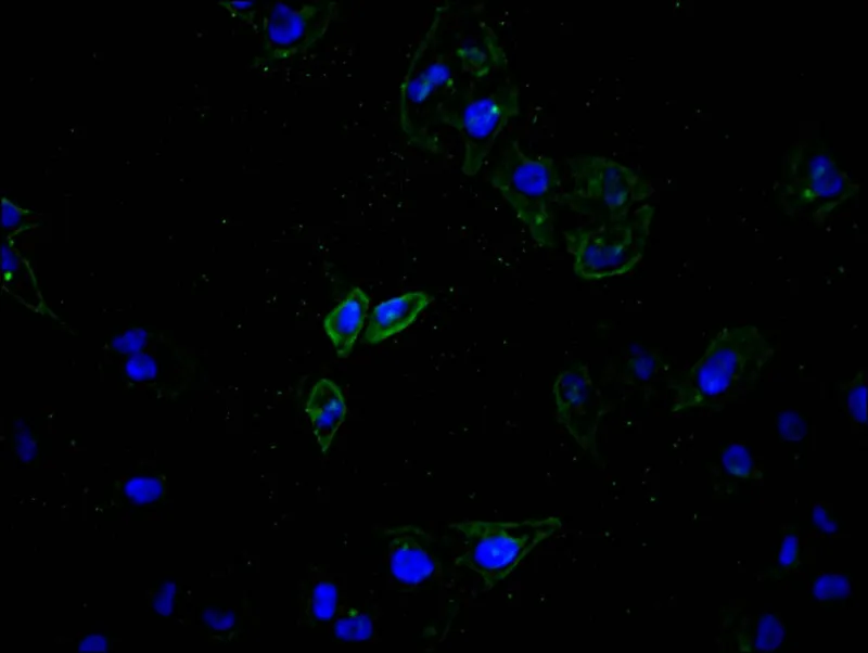 ATP7B Recombinant Monoclonal Antibody - image 1