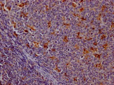 CTSS Recombinant Monoclonal Antibody - image 1