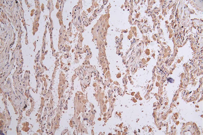 LGR6 Recombinant Monoclonal Antibody - image 1
