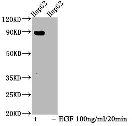 Phospho-STAT5A (Y694) Recombinant Monoclonal Antibody - image 1