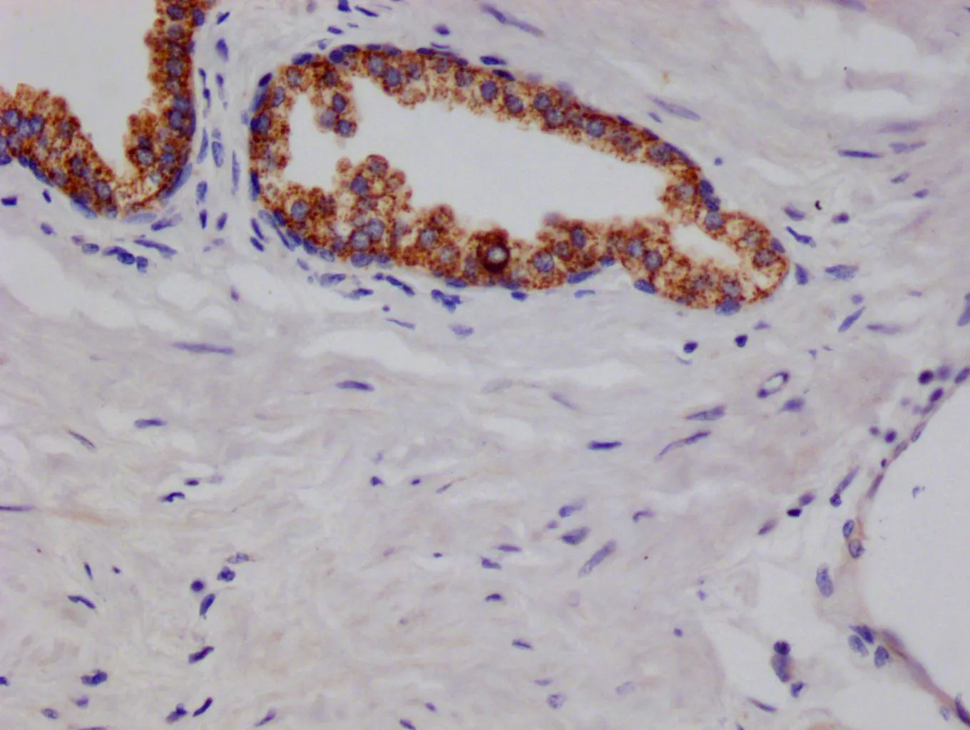 ARG2 Recombinant Monoclonal Antibody - image 1