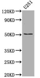 TP53 Recombinant Monoclonal Antibody - image 1