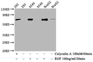 Phospho-ATF2 (T71) Recombinant Monoclonal Antibody - image 1
