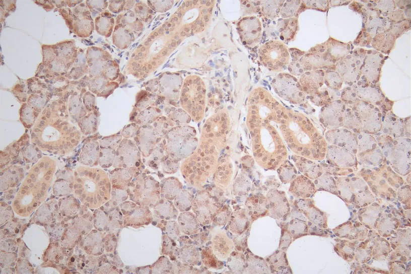 HMGB1 Recombinant Monoclonal Antibody - image 1