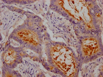 CEACAM1 Recombinant Monoclonal Antibody - image 1