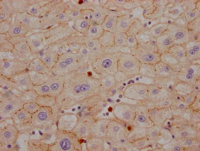 CEACAM1 Recombinant Monoclonal Antibody - image 2