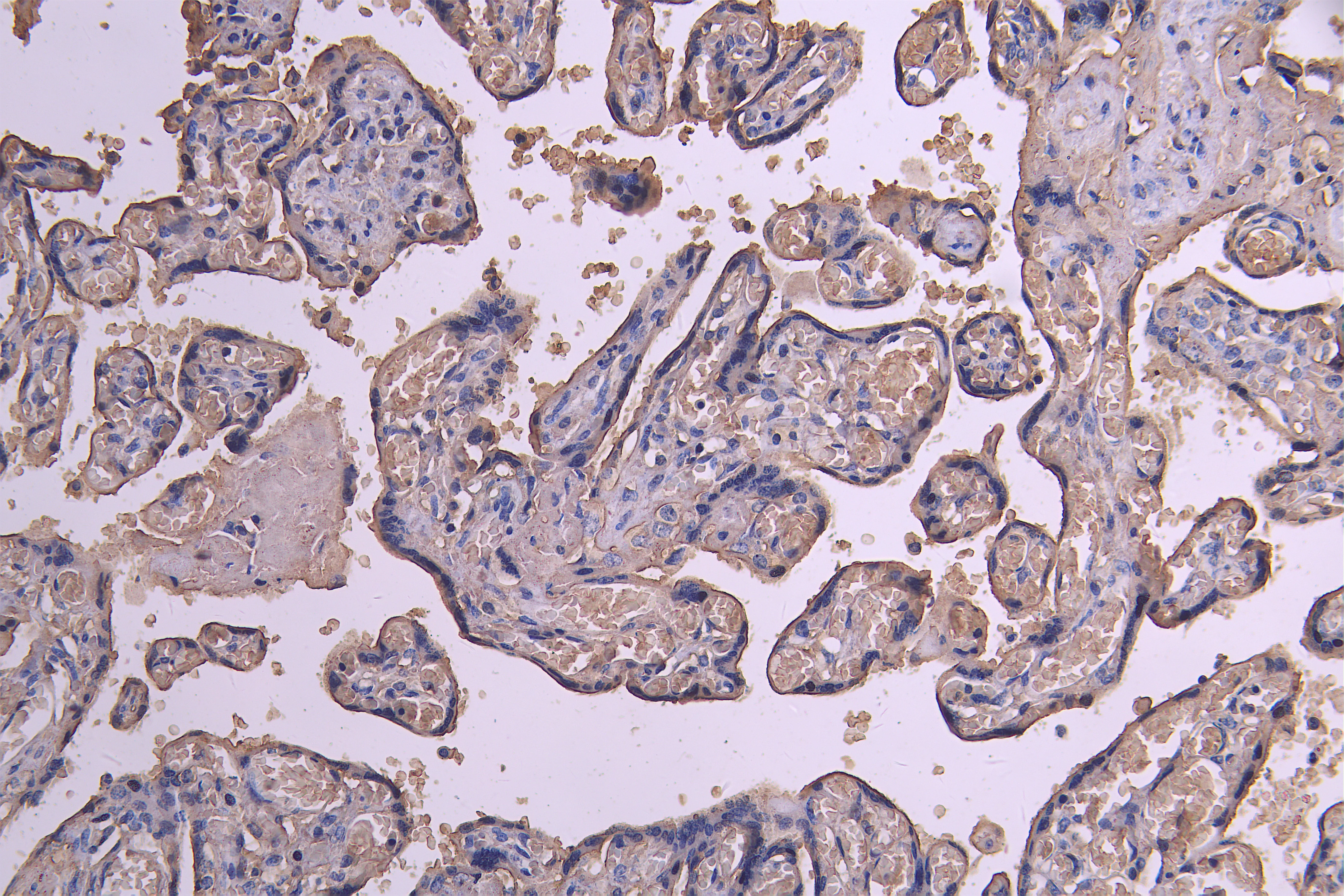 ACVR2B Recombinant Monoclonal Antibody - image 1