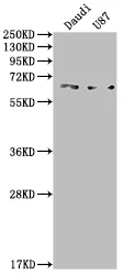 ACVRL1 Recombinant Monoclonal Antibody - image 1