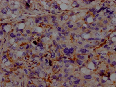 ACVRL1 Recombinant Monoclonal Antibody - image 2