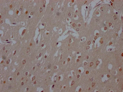 COMT Recombinant Monoclonal Antibody - image 2