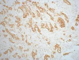 AMACR Monoclonal Antibody - image 1