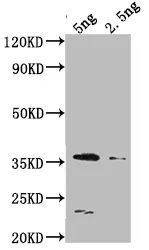 DCM Antibody - image 1