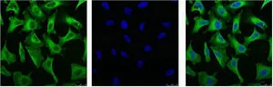 EGFR Monoclonal Antibody - image 1
