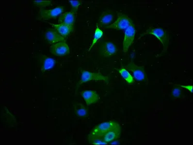 Phospho-TP53 (S9) Recombinant Monoclonal Antibody - image 1