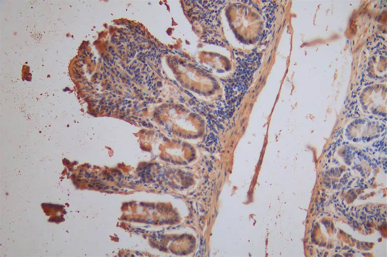 XPNPEP1 Recombinant Monoclonal Antibody - image 1