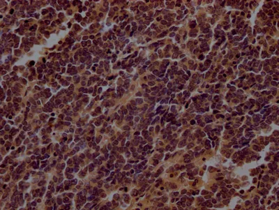 TERT Recombinant Monoclonal Antibody - image 1