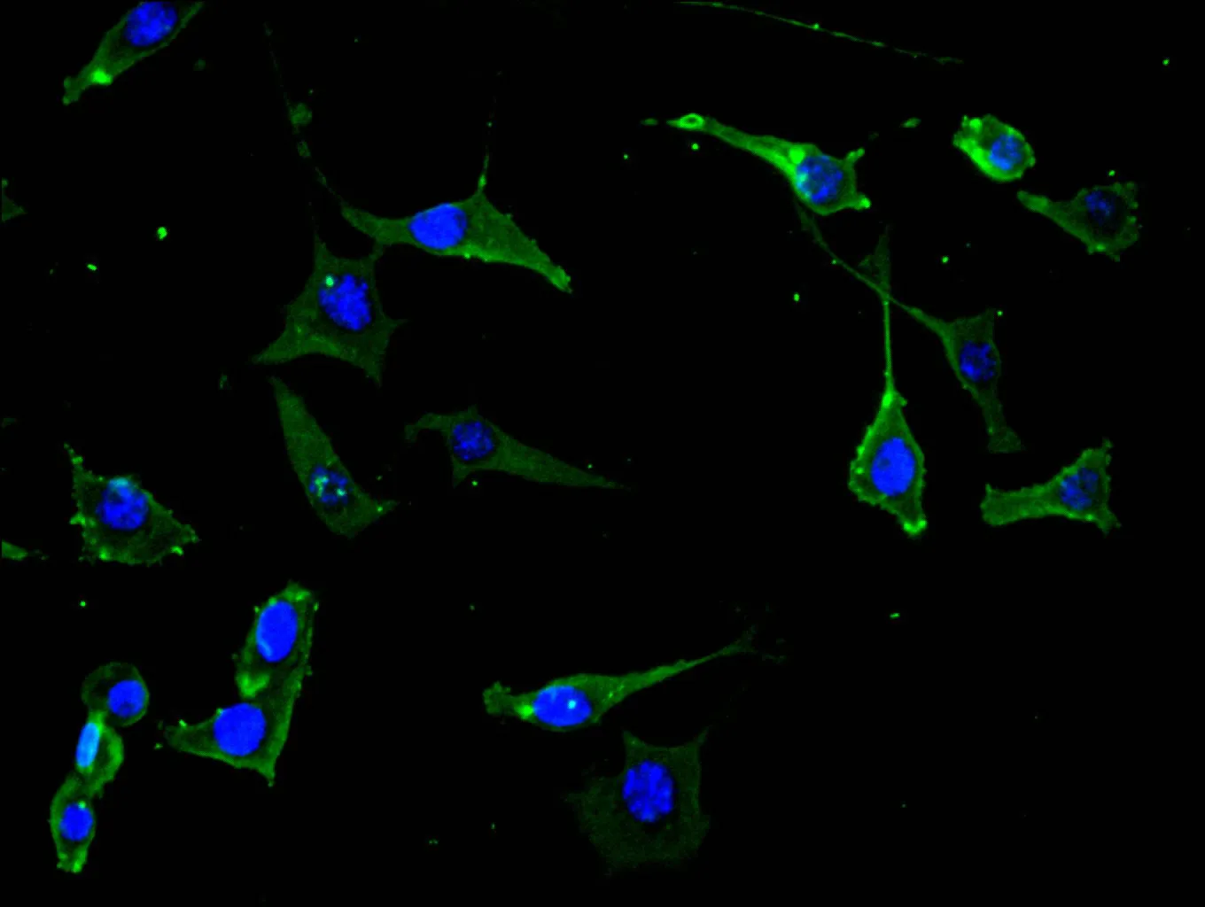 NTRK2 Recombinant Monoclonal Antibody - image 1
