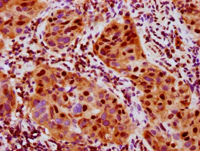 Phospho-RPS6KA5 (S376) Recombinant Monoclonal Antibody - image 1