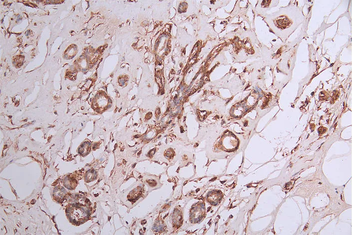 DPYSL2 Recombinant Monoclonal Antibody - image 1