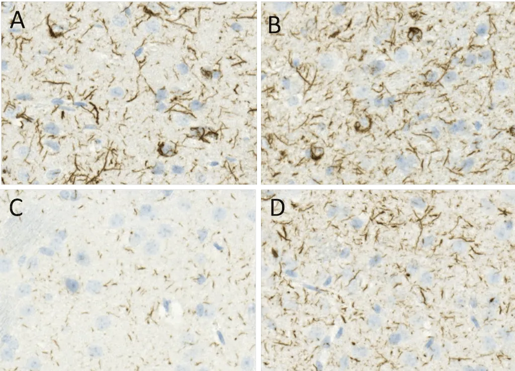 Alpha Synuclein Pre-formed Fibrils (Type 1) - image 3