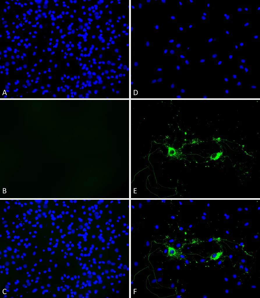 Alpha Synuclein Pre-formed Fibrils (Type 1) - image 1