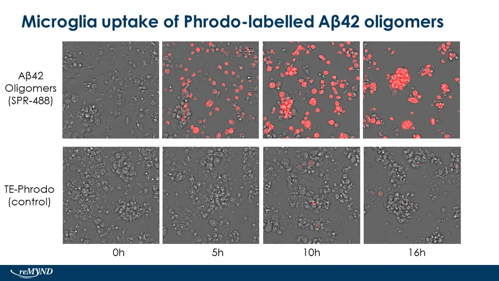 Amyloid Beta 1-42 Oligomers - image 4