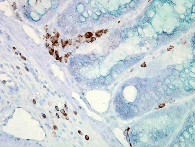 HSP70 Antibody: ATTO 488 - image 1