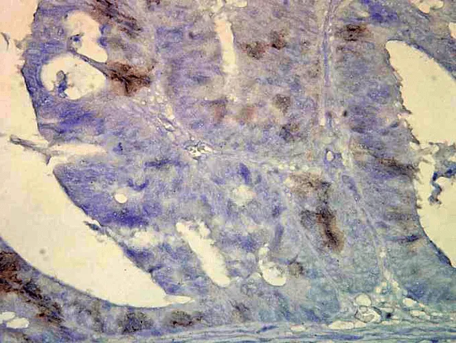 HSP70/HSC70 Antibody: FITC - image 2