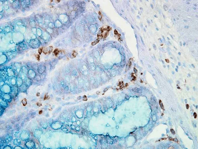 HSP90 alpha Antibody - image 3