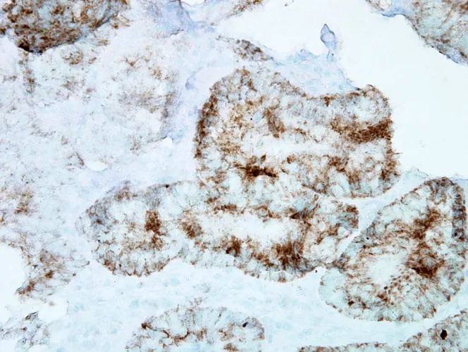 HSP60 Antibody - image 2