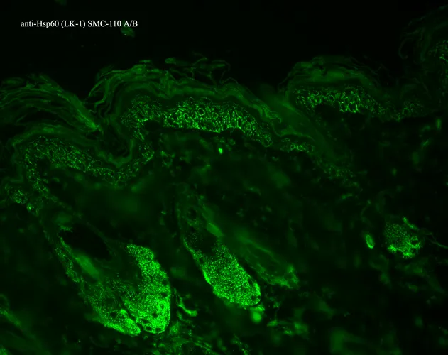 HSP60 Antibody - image 4