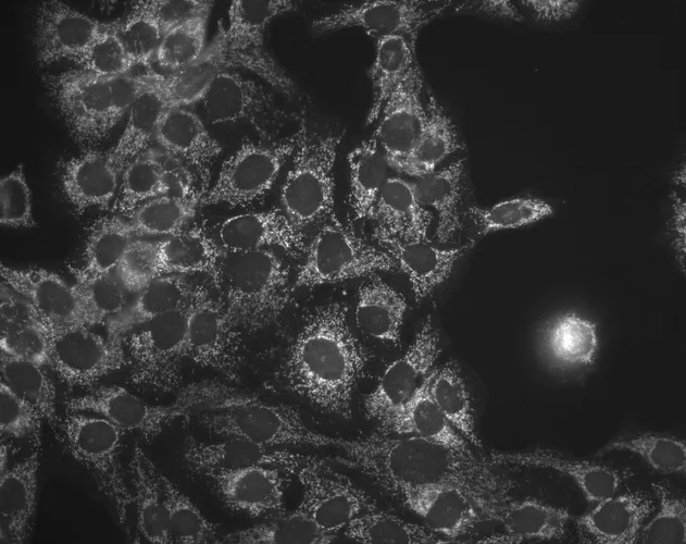 HSP60 Antibody - image 1